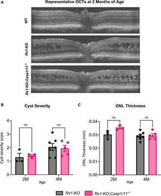 Investigating the role of Caspase-1 in a mouse model of Juvenile X-linked Retinoschisis